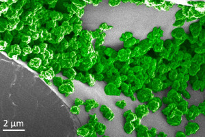 Leuchtende Nanopartikel in extremer Vergrößerung (Foto: mit.edu)