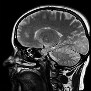 MRT-Scan: Aktivierung im Gehirn wird in Echtzeit sichtbar gemacht (Foto: pixabay.com, kalhh)