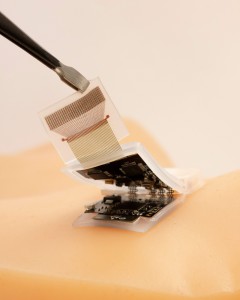 Tragbares Ultraschallgerät: Es wird einfach aufgeklebt (Foto: Muyang Lin, ucsd.edu)