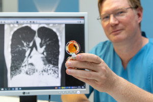 Felix Ringshausen: PCD-Patienten sollen wieder freier atmen (Foto: Karin Kaiser, mhh.de)