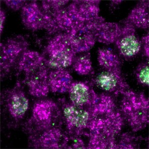 UV: Ribosome wichtiger als DNA (Foto: hopkinsmedicine.org, Zhong Yeow, Niladri Sinha)