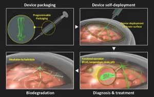 Von der Implantation des Sensors bis zur Selbstauflösung (Illustration: Jae-Young Bae, en.snu.ac.kr)