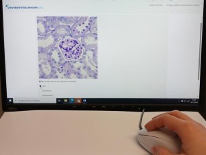 Selbst Experten erkennen KI-Gewebeschnittbilder nicht zuverlässig (Foto: uniklinikum-jena.de)